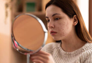 What-is-pigmentation-and-how-does-it-affect-your-skin