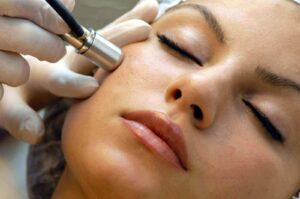 Microdermabrasion Treatment 