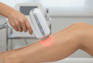 Laser hair removal