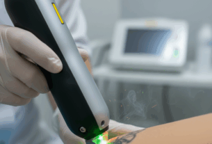 Q-Switch Laser Treatment