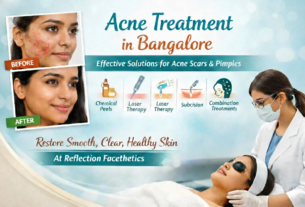 Acne Treatment