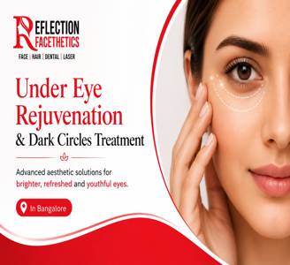 Dark Circles Treatment in Bangalore