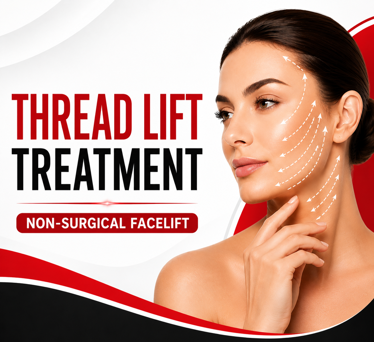 Thread Lift Treatment in Bangalore