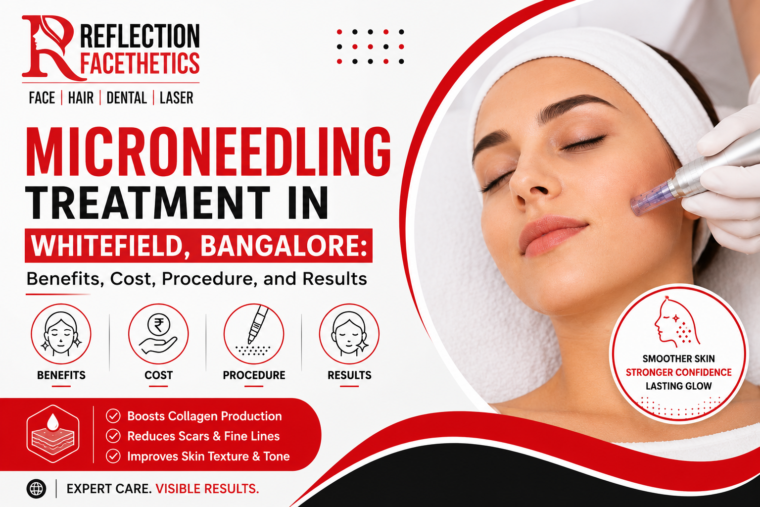 Microneedling Treatment in Whitefield