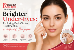 Dark Circles Treatment in Whitefield