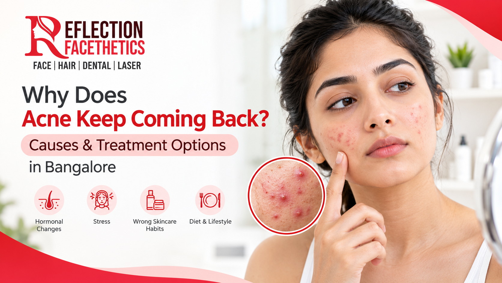 Acne Treatment in Bangalore