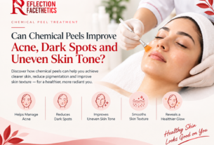 Chemical Peel in Banglore