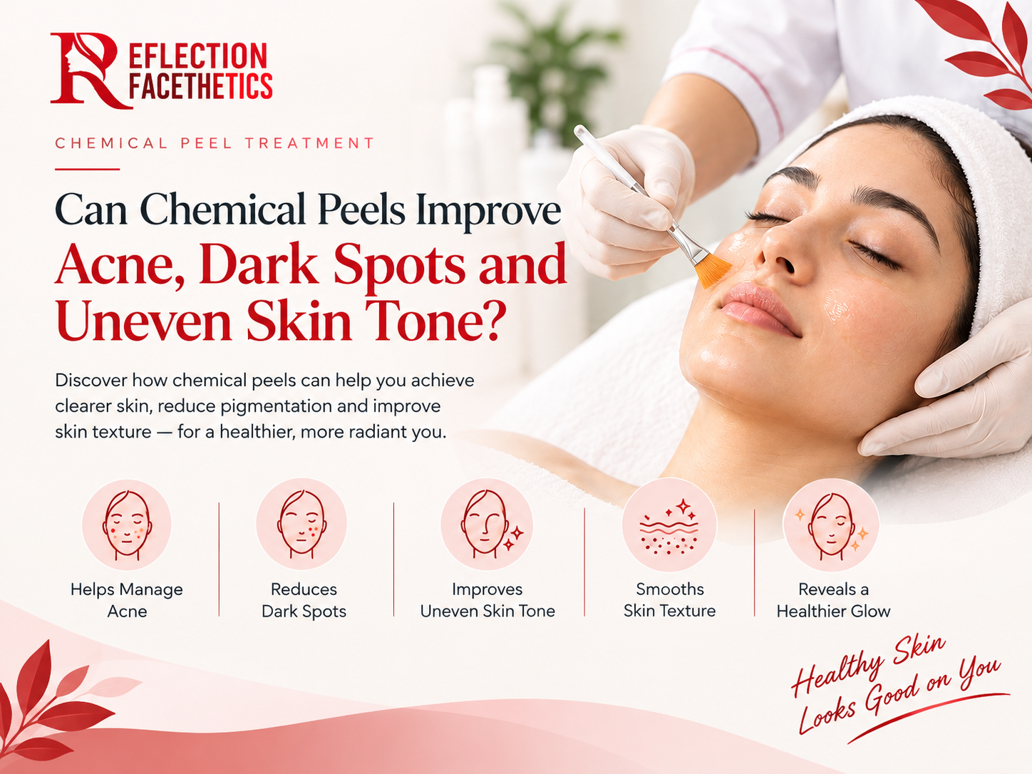 Chemical Peel in Banglore