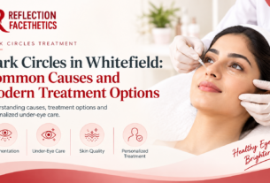 Dark Circles Removal Treatment in Bangalore