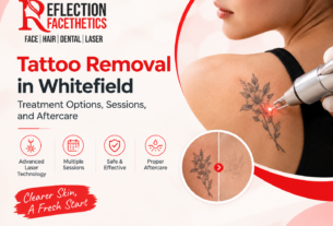 Tattoo Removal in Whitefield