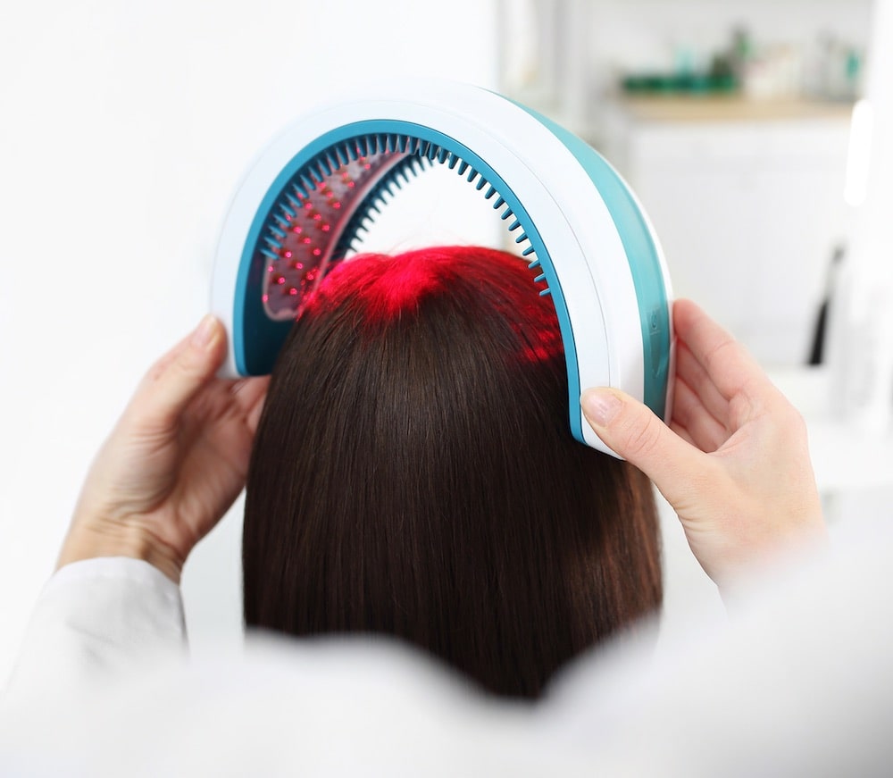 Low Level Laser Hair Therapy in Bangalore