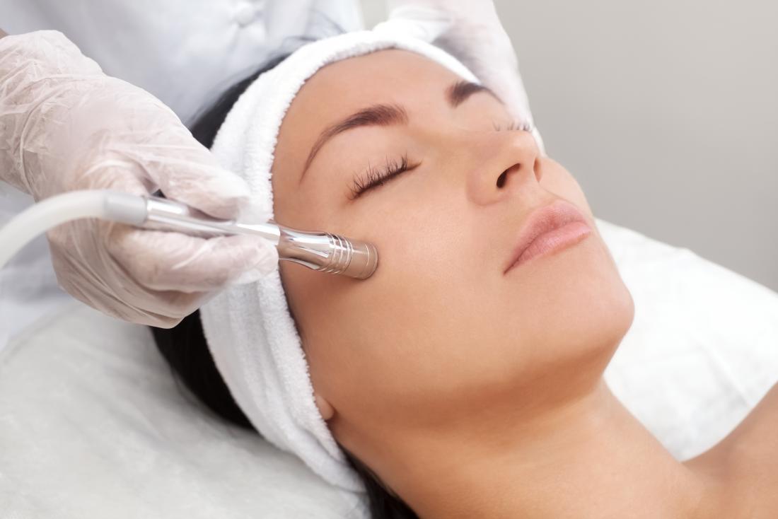 Microdermabrasion Treatment in Bangalore