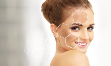 Pigmentation Treatment in Bangalore