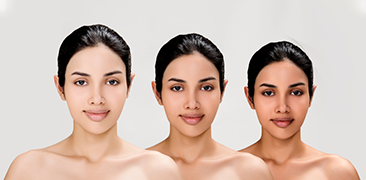 Skin Lightening Treatment in Bangalore